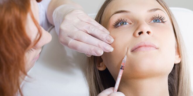 Zdvihnutie poklesnutých kútikov kyselinovu hyalurónovou v Salóne Dermafresh