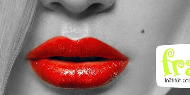 „Sexy lips“ zväčšenie pier kyselinou hyalurónovou