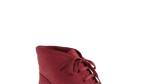Dámske červené členkové topánky s pusinkou Lola Ramona