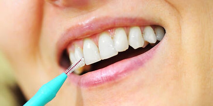 Dentálna hygiena alebo profesionálne bielenie zubov s medzizubnou kefkou GRÁTIS