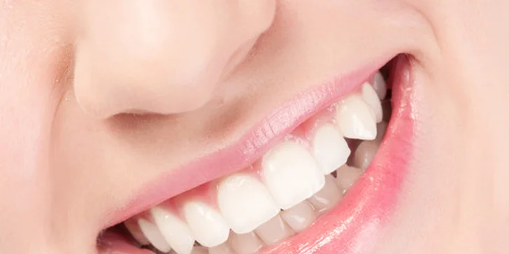 29 eur za kompletnú dentálnu hygienu. Zdravý chrup a žiarivý úsmev, so zľavou až 61 %!