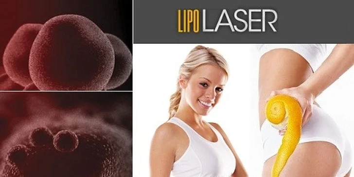 LIPOlaser - najúčinnejší spôsob tvarovania postavy s okamžitým účinkom