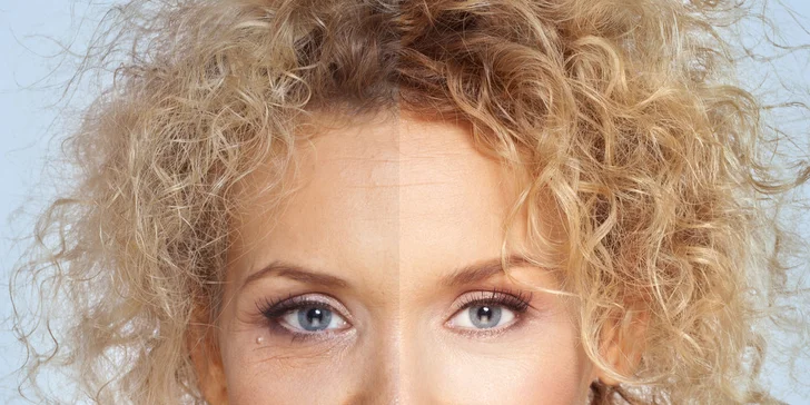 Fotoomladenie pleti IPL metódou