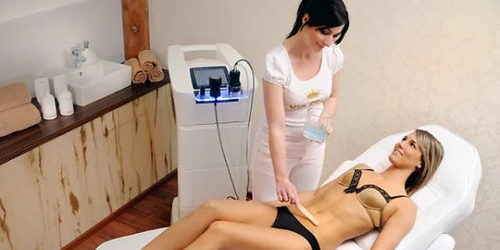 Neobmedzená kryolipolýza počas 3 alebo 6 mesiacov