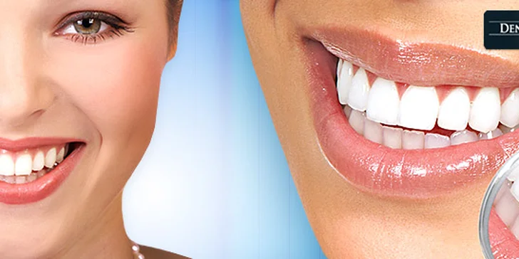 Bielenie zubov Ultradent – Opalescente Boost PF