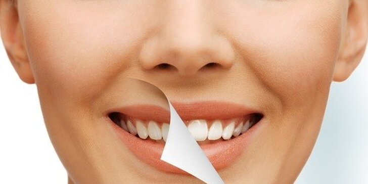 Profesionálne bielenie zubov bez peroxidu