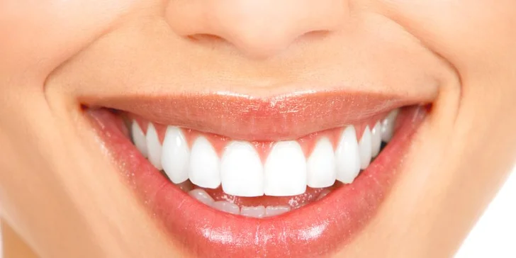 Dentálna hygiena alebo bielenie zubov