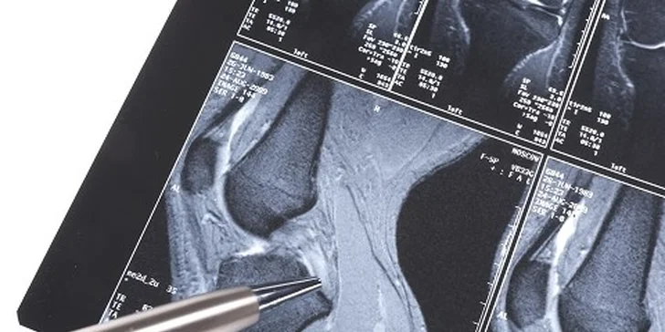 Vyšetrenie MAGNETICKOU REZONANCIOU malého kĺbu alebo chrbtice
