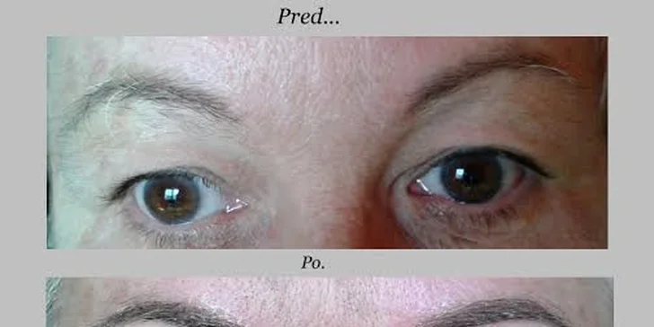 Dokonalé obočie s permanentným makeupom tetované špeciálnymi čepieľkami