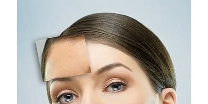 3D lifting alebo fotorejuvenizácia 2v1 pre zdravú a mladú pleť