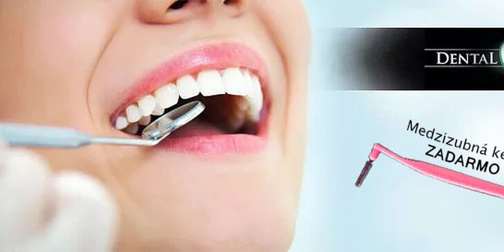 Top ambulantná dentálna hygiena alebo bielenie zubov