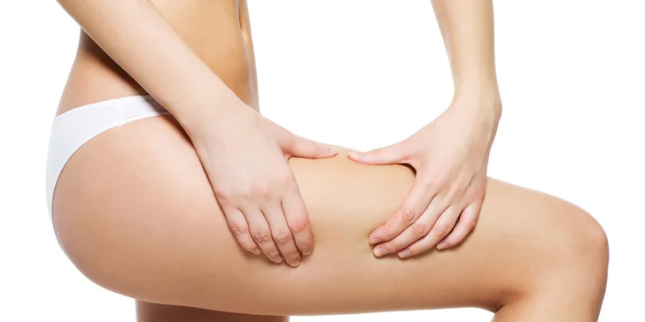 Slávna trojka pre krásnu postavu: kavitácia, Vacushape a lymfodrenáž