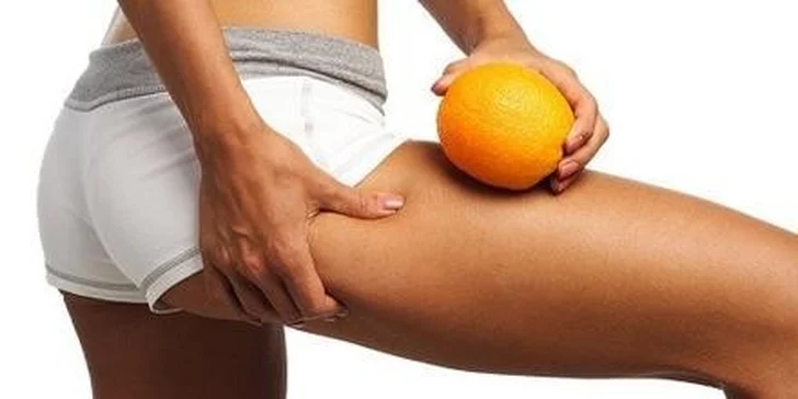 Manuálna anticelulitídna masáž v štúdiu Masáže Relax v Bardejove