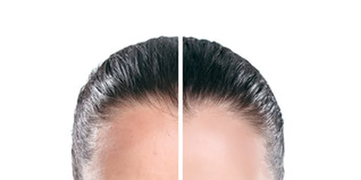 3D lifting alebo fotorejuvenizácia 2v1 pre zdravú a mladú pleť