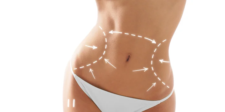 Účinné chudnutie! LipoLaser a kryolipolýza