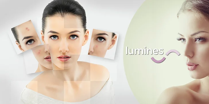 Chemický píling Zymo Synergy Peel®