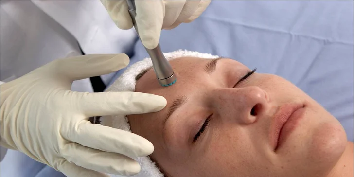 Diamantová dermabrázia a čokoládová masáž - hodinové ošetrenie