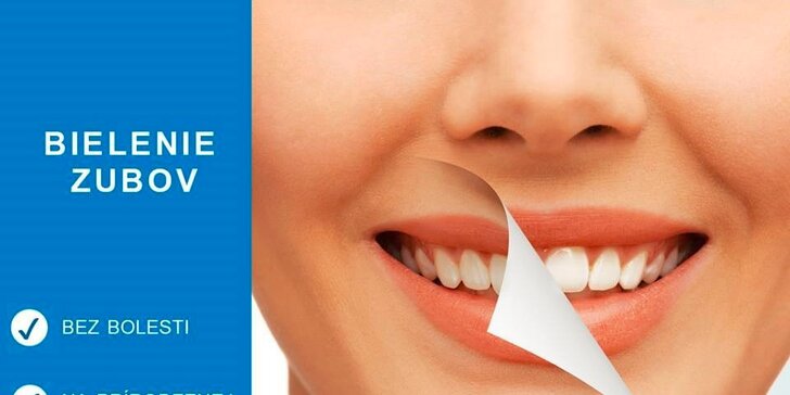 Certifikované bielenie zubov SMILEPOINT na prirodzenej báze