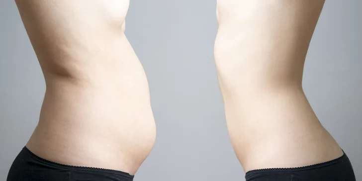 Štíhla s neinvazívnou liposukciou Vital Injector Lipolysis – Mesoline Slim & Bodyfirm