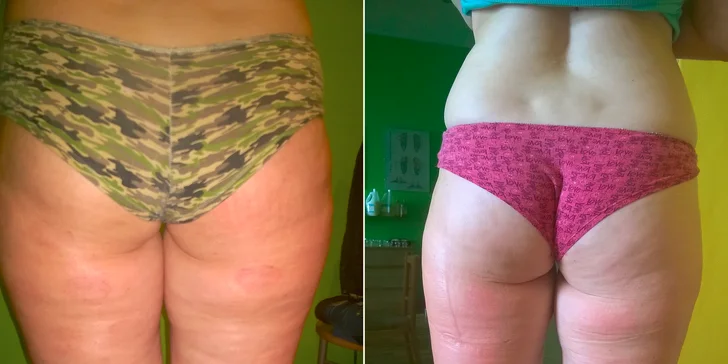 7 druhov masáží v trvaní 60 minút pre vašu regeneráciu