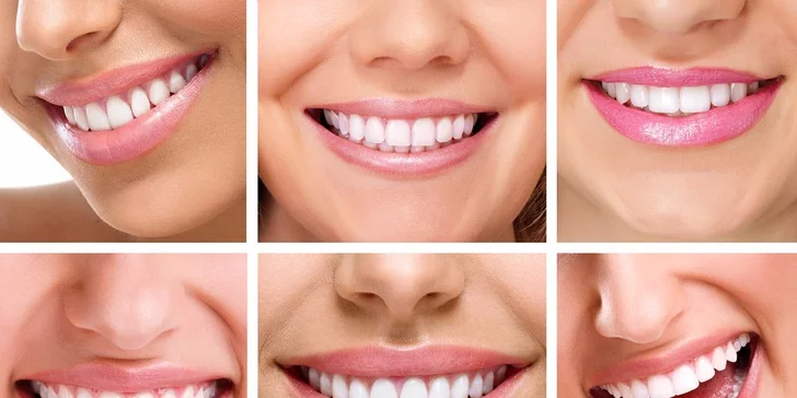 Profesionálna dentálna hygiena v stomatologickej ambulancii - OTVORENÉ AJ V SOBOTU