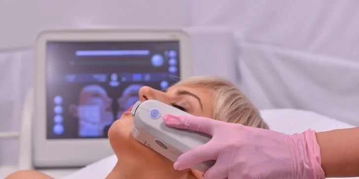 Ultherapia - nechirurgický dolný lifting líc pre mladistvú tvár