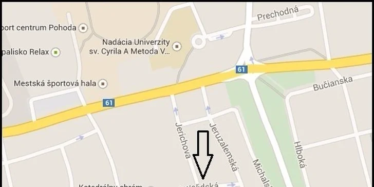 Permanentná fotoepilácia vybraných oblastí výkonným prístrojom SHR BETA