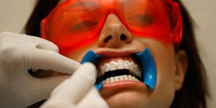 Predĺžené ošetrenie: Laserové bielenie zubov až 45 minút!