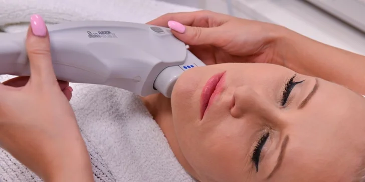 Ultherapia – nechirurgický facelift podbradku