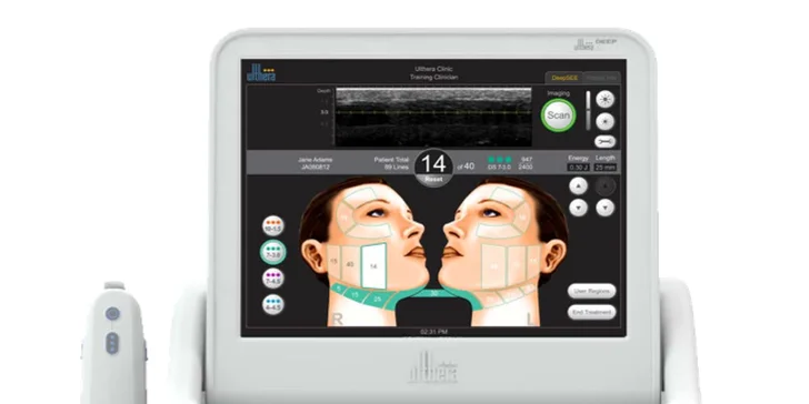 Ultherapia – nechirurgický facelift podbradku