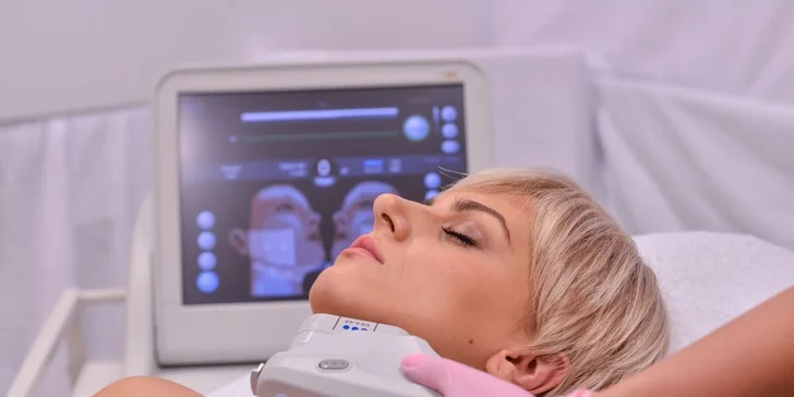 Ultherapia – nechirurgický facelift podbradku