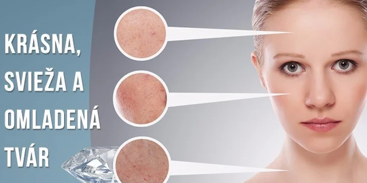 Diamantová mikrodermabrázia a ošetrenie ozónizérom + úprava obočia