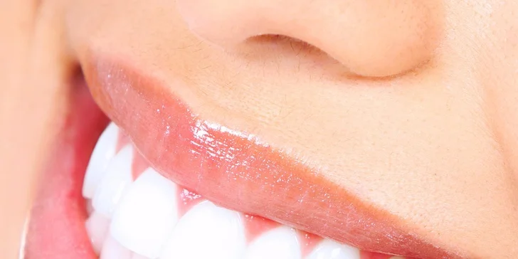 Profesionálna dentálna hygiena
