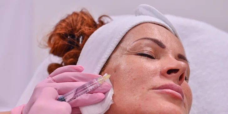 Vitamínová mezoterapia - omladzujúca bomba pre vašu pleť či vlasy!
