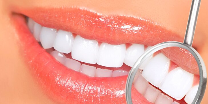 Profesionálne bielenie zubov či dentálna hygiena pre deti