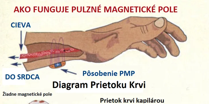Diagnostika zdravia kvantovým rezonančným magnetickým analyzátorom či balík zdravia