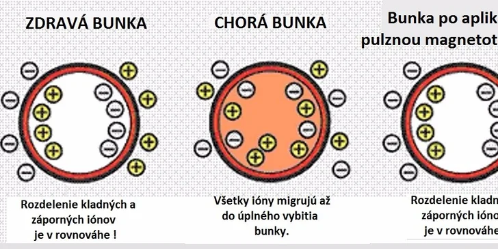 Diagnostika zdravia kvantovým rezonančným magnetickým analyzátorom či balík zdravia