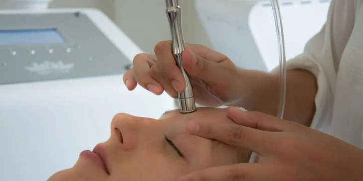 Mikrodermabrázia a mezoterapeutické zapravenie kyseliny hyalurónovej