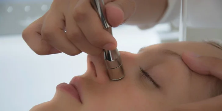 Mikrodermabrázia a mezoterapeutické zapravenie kyseliny hyalurónovej
