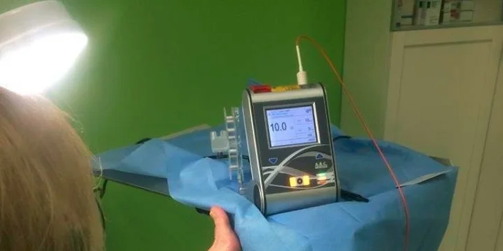 Laserové ošetrenie plesňového ochorenia nechtov