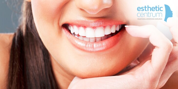 Šetrné bielenie zubov bez peroxidu