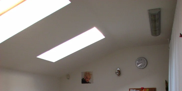 Krásna a jemná pleť s diamantovou mikrodermabráziou