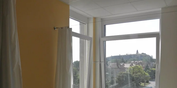 Odstránenie neestetických rozšírených žiliek špecializovaným cievnym lekárom