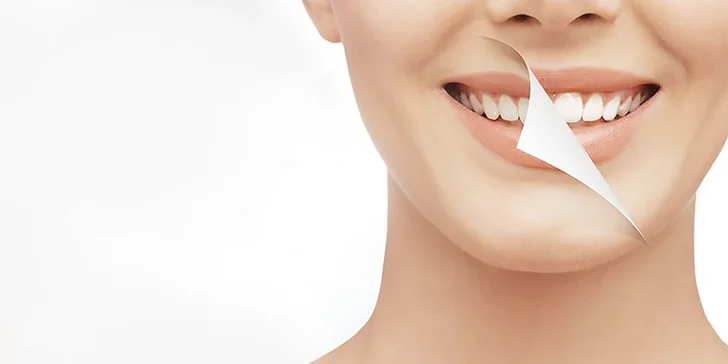 Certifikované bielenie zubov SMILEPOINT na prirodzenej báze