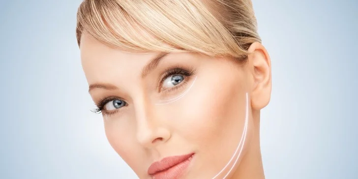 Rádiofrekvenčný facelifting pleti
