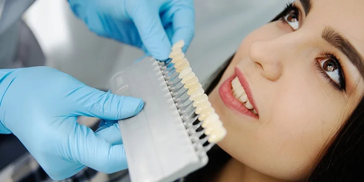 Profesionálne bielenie zubov Power Whitening aj s dentálnou hygienou