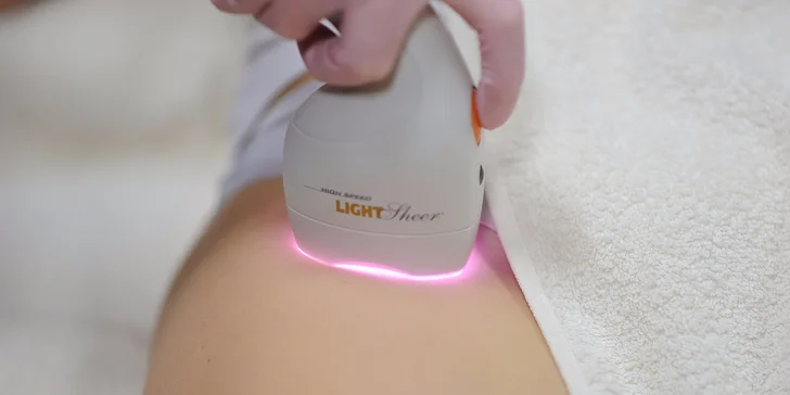 Bezbolestná epilácia diódovým laserom Lumenis LightSheer