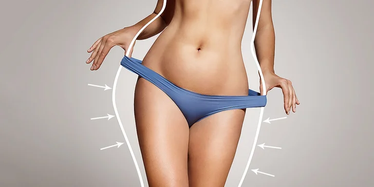 Laserová liposukcia s lymfodrenážou