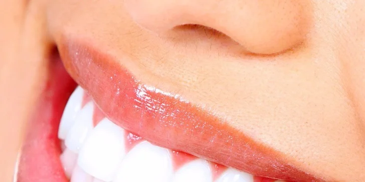 Komplexná profesionálna dentálna hygiena