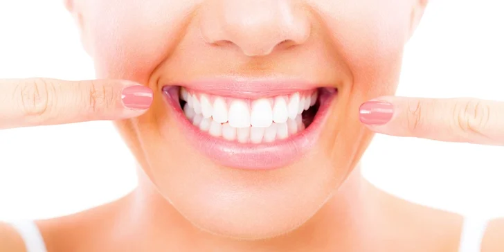 Nemecké či klasické bielenie zubov alebo dentálna hygiena